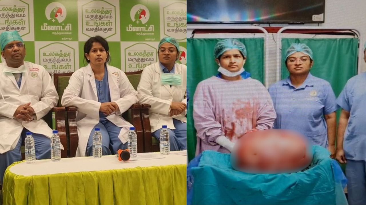2 ஆண்டுகளாக அவதிப்பட்ட பெண்.. 27 கிலோ கட்டியை அகற்றிய மருத்துவர்கள்