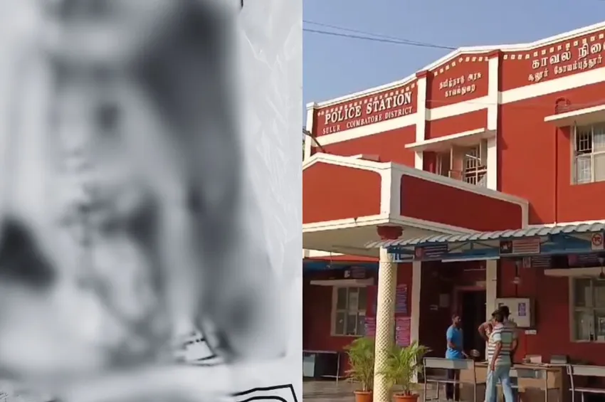 கோவை அருகே கண்டெடுக்கப்பட்ட மனித கை.. போலீசார் விசாரணையில் விலகிய மர்மம்!
