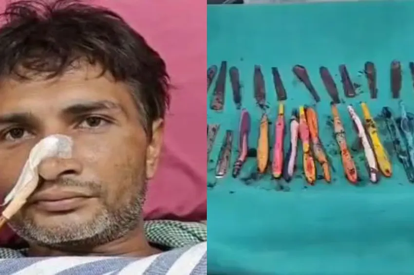 29 ஸ்பூன்கள், 19 டூத் பிரஷ்களை விழுங்கிய இளைஞர்.. அறுவை சிகிச்சை மூலம் அகற்றம்!