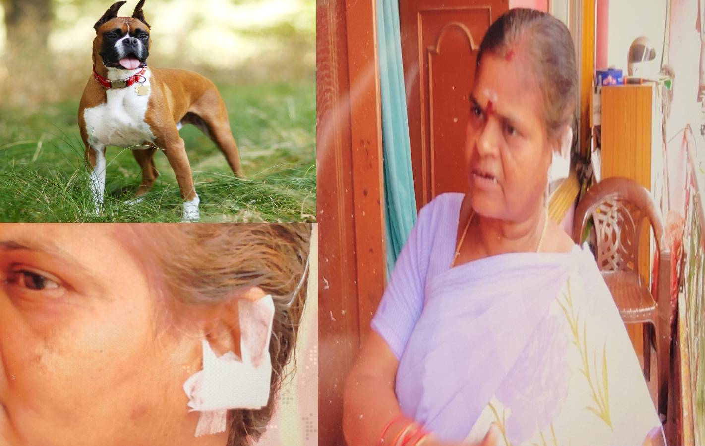 பெண்ணின் காதை கடித்த 4 பாக்ஸர் நாய்கள்.. அலட்சியத்தில் உரிமையாளர்.. பாதிக்கப்பட்ட பெண் போலீசில் புகார்!