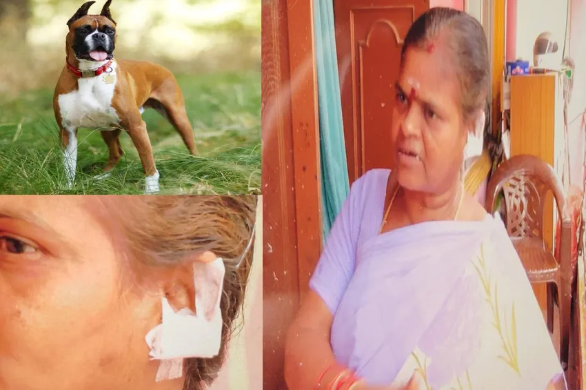 பெண்ணின் காதை கடித்த 4 பாக்ஸர் நாய்கள்.. அலட்சியத்தில் உரிமையாளர்.. பாதிக்கப்பட்ட பெண் போலீசில் புகார்!