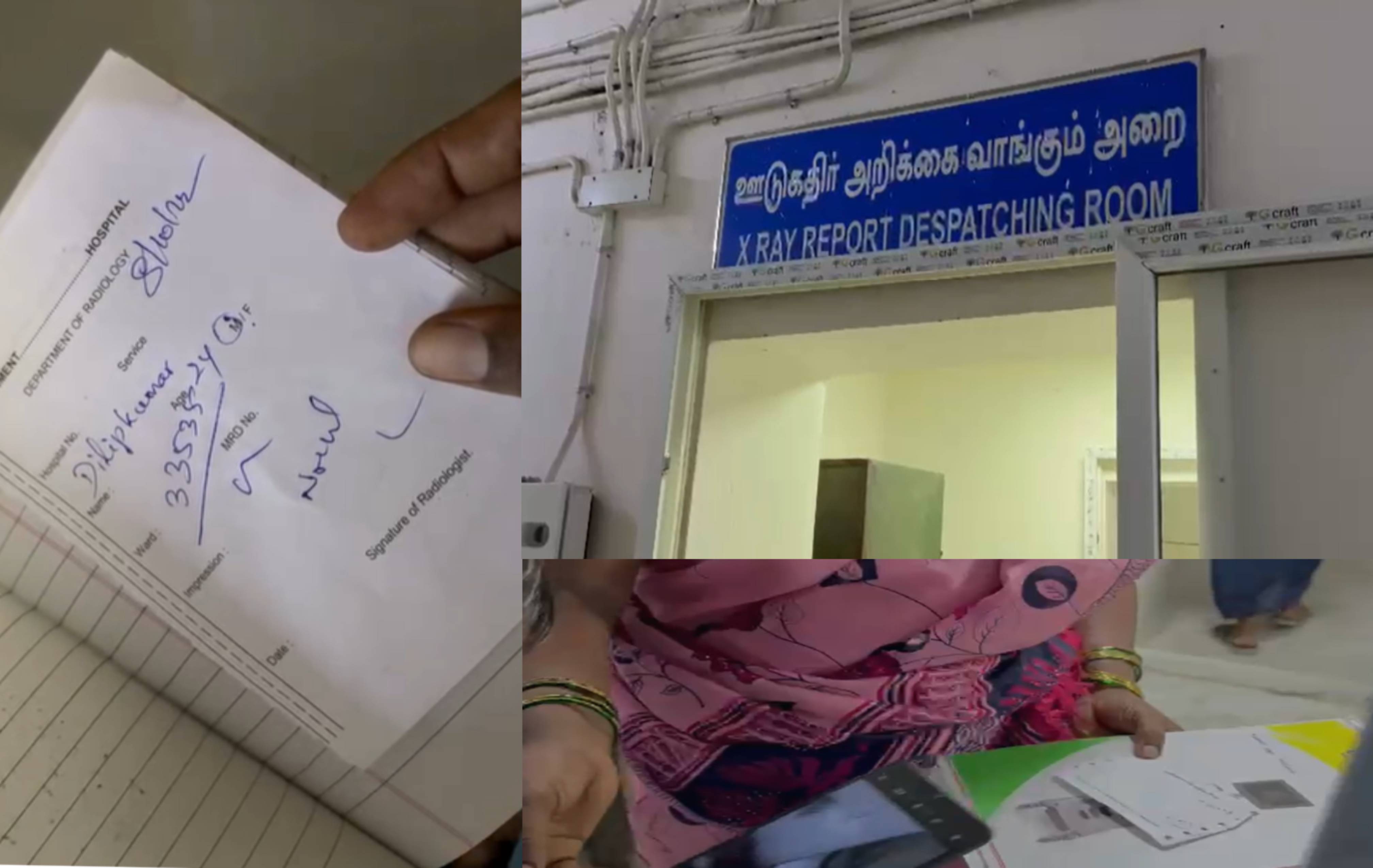 எழும்பூர் குழந்தைகள் நல மருத்துவமனை அவலம்: எக்ஸ்ரே ஃபிலிம் இல்லாததால் முடிவுகள் எழுத்துவடிவில் தாமதம் - பெற்றோர் கடும் அவதி!