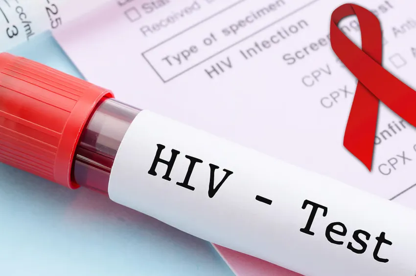 பெருநகரங்களில் மாறும் பாலியல் கலாசாரம்... அதிகரிக்கும் HIV அச்சம்!