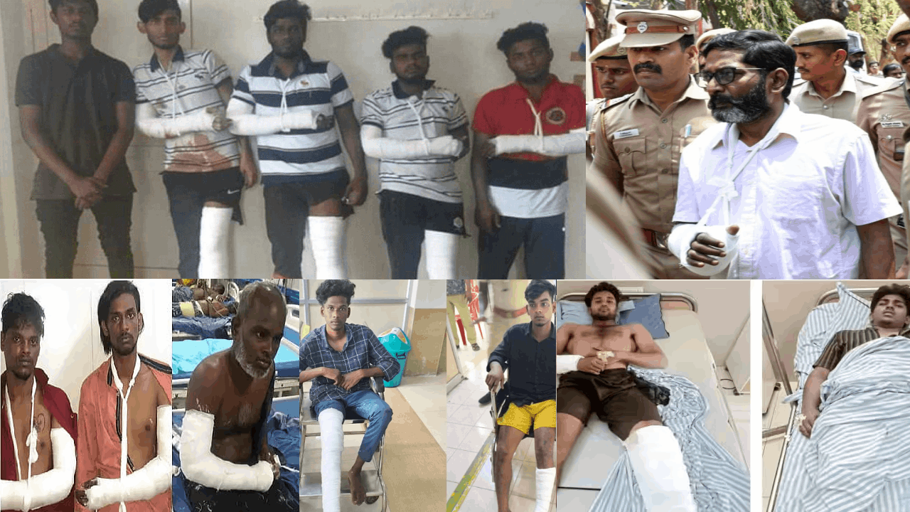 குற்றம் சாட்டப்பட்டவர்களுக்கு மாவுக்கட்டு.. 'அது எப்படின்ணே' - பாயிண்ட்ட புடிச்ச நீதிமன்றம்!