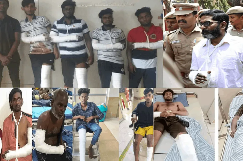 குற்றம் சாட்டப்பட்டவர்களுக்கு மாவுக்கட்டு.. 'அது எப்படின்ணே' - பாயிண்ட்ட புடிச்ச நீதிமன்றம்!